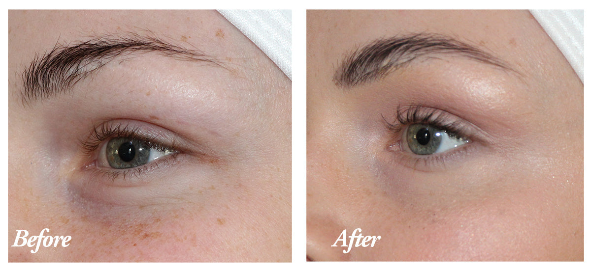 Results after two weeks of Face Oil